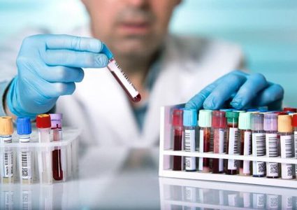 كورونا يحصد أرواح نحو 656 ألف شخص حول العالم