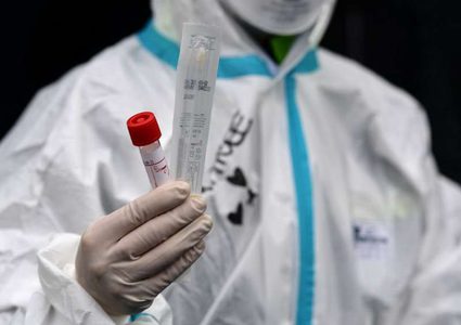 كورونا عالميا: أكثر من 662 ألف وفاة والاصابات تقترب من ال 17مليون