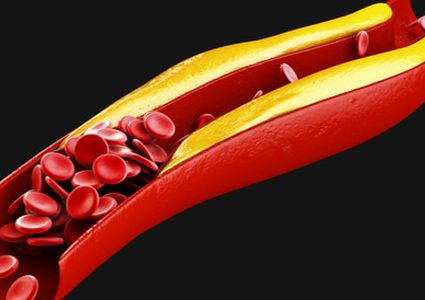 تحذير.. هذه الأطعمة تزيد من الكوليسترول الضار في الجسم