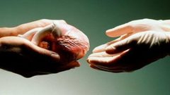 كيف تتم عملية التبرع بأعضاء شخص متوفي ؟