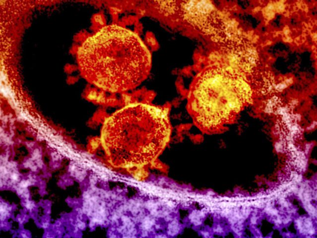 هل تساعد أدوية السرطان والإدمان في علاج كورونا ؟