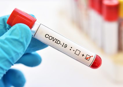 514 إصابة جديدة بكورونا في فلسطين خلال 24 ساعة