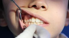 دراسة: أمراض اللثة تزيد فرص المعاناة من مضاعفات كورونا