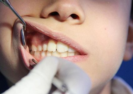 دراسة: أمراض اللثة تزيد فرص المعاناة من مضاعفات كورونا