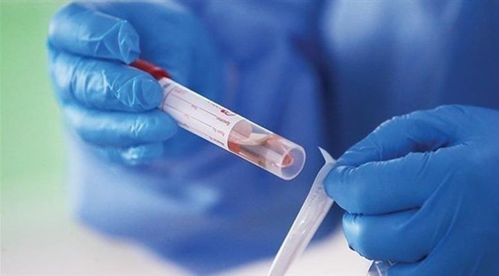 تسجيل 14 اصابة جديدة بكورونا في قلقيلية