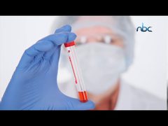 كم سيكون سعر لقاح كورونا المرتقب؟