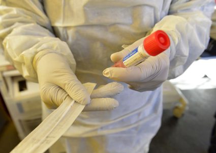 مختبرات ألمانيا تتبرع بـ3500 عينة مسح كورونا إلى مستشفى الهمشري