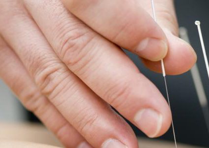 هل يمكن أن يساعد "العلاج بالوخز" مرضى كورونا ؟