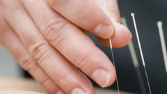 هل يمكن أن يساعد "العلاج بالوخز" مرضى كورونا ؟