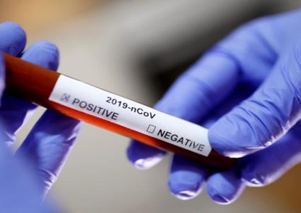 محافظ قلقيلية: تسجل 9 اصابات جديدة بفيروس كورونا