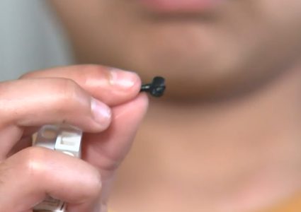 العثور على قطعة ليغو فقدت منذ عامين في أنف طفل !