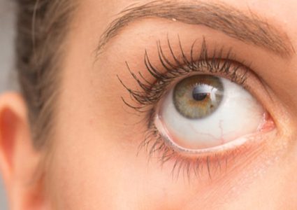 تحذير.. نقص هذا الفيتامين يؤدي لظهور زوائد رغوية في العين