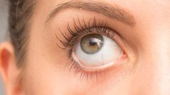 تحذير.. نقص هذا الفيتامين يؤدي لظهور زوائد رغوية في العين