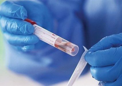 عفيف عطاونة: الخليل سجلت 11250اصابة و102حالة وفاة منذ تفشي كورونا