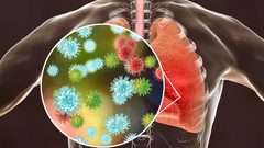 كيف سيواجه العالم الإنفلونزا وكورونا في الشتاء ؟