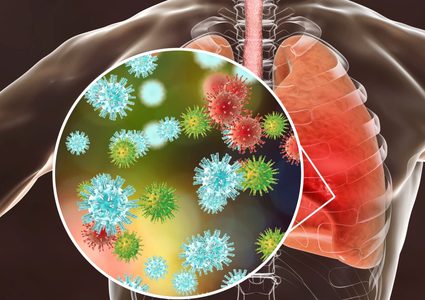 كيف سيواجه العالم الإنفلونزا وكورونا في الشتاء ؟