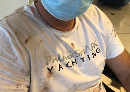 الطيبة: شرطة الاحتلال تعتدي على رجل بالضرب وتصيبه بجروح متوسطة