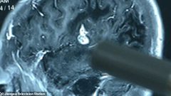 شاب صيني يعاني من مشكلة صادمة بسبب تناوله الثعابين والضفادع