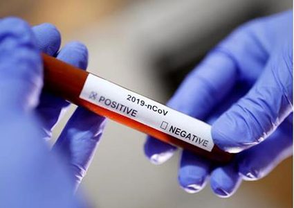 مصر: 176 اصابة جديدة بفيروس كورونا ز19 حالة وفاة