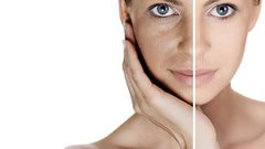 أخصائية بشرة تتحدث عن تصبغات البشرة وطرق التعامل معها