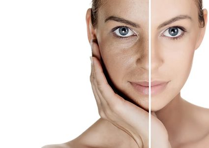 أخصائية بشرة تتحدث عن تصبغات البشرة وطرق التعامل معها