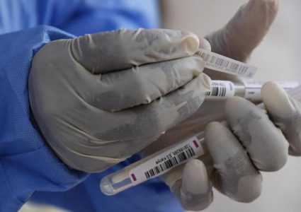 روسيا: استخلاص علاج لفيروس كورونا من رئة الثور