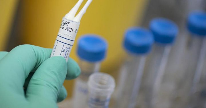 شركة أدوية أمريكية توقف تطوير لقاح كورونا في مراحله الاخيرة