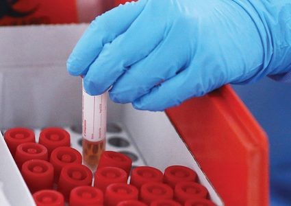 تسجيل 19 حالة وفاة و187 اصابة جديدة بفيروس كورونا في مصر