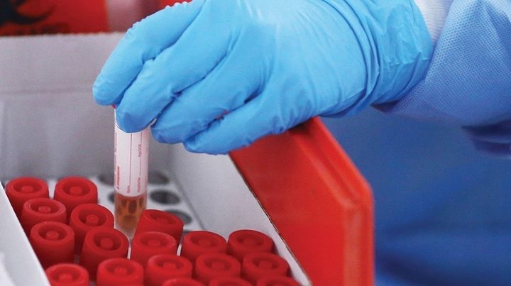 تسجيل 19 حالة وفاة و187 اصابة جديدة بفيروس كورونا في مصر
