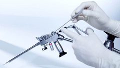 طبيب مختص: "العلاج بالمناظير أكثر فعالية من الجراحات التقليدية"