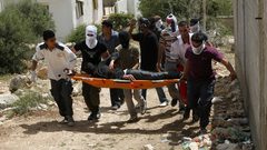 إصابة 3 مواطنين بالرصاص المعدني خلال قمع الاحتلال مسيرة كفر قدوم