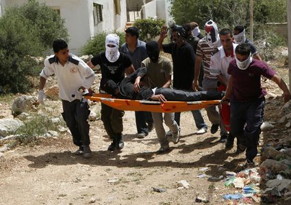 إصابة 3 مواطنين بالرصاص المعدني خلال قمع الاحتلال مسيرة كفر قدوم