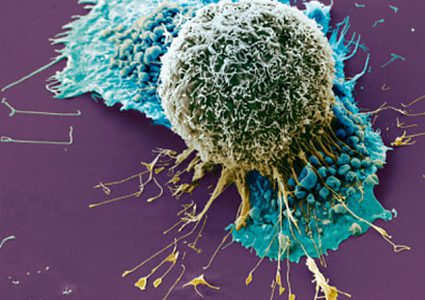 متى يجب عليك الذهاب لطبيب الأورام ؟