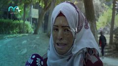 فتاة من غزة تبحث عن أمل يعيد لها ملامح طمستها الحروق