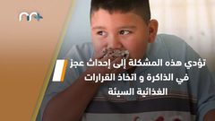 السمنة تحد من مستوى الذكاء .. كيف ذلك؟