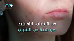 ما هي الحالات التي تجبرك على التوقف عن شرب الحليب؟