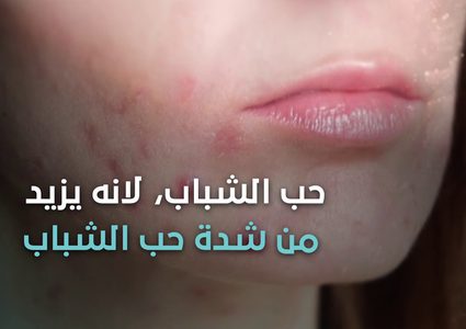 ما هي الحالات التي تجبرك على التوقف عن شرب الحليب؟