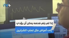 السجائر الإلكترونية تدمر الحمض النووي كيف ذلك؟