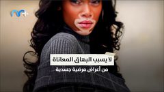 أبرز الحقائق حول مرض البهاق الجلدي