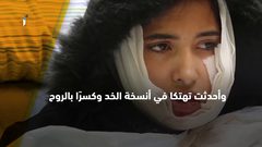 إصابة الشابة نعم الصوصة الطالبة في جامعة خضوري