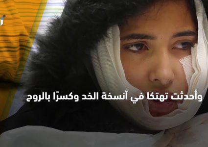 إصابة الشابة نعم الصوصة الطالبة في جامعة خضوري