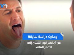 تحذير .. لون اللسان ينبىء بأزمة صحية قاتلة