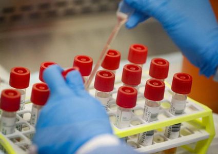 الصحة: عينات فحص كورونا بالضفة تكفي لأيام فقط