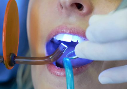 تركيا.. رحلة علاج لتبييض الأسنان تنتهي بكارثة مروعة !