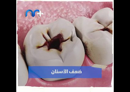 علامات واضحة تؤكد نقص الكالسيوم في جسمك