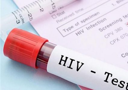 تطوير علاج جديد لمرض الإيدز