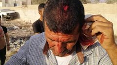 إصابة مواطن جراء اعتداء للمستوطنين على قرية عصيرة القبلية