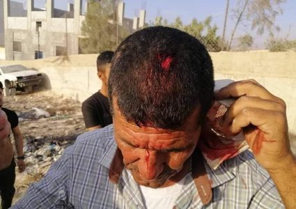 إصابة مواطن جراء اعتداء للمستوطنين على قرية عصيرة القبلية
