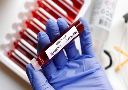 إكتشاف عارض رابع للإصابة بفيروس كورونا