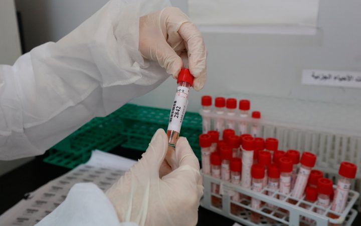 4 وفيات و576 إصابة جديدة بـ"كورونا" خلال الـ 24 ساعة الأخيرة